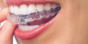 Innovations in orthodontic patient care